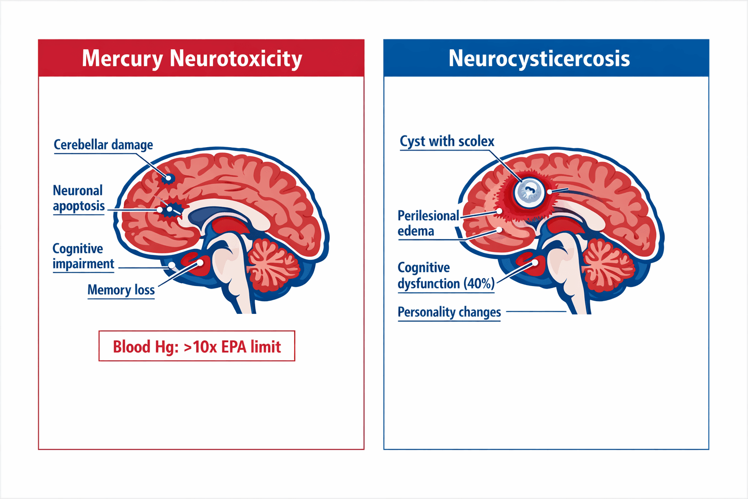 Medical infographic comparing two neurological conditions: Mercury Neurotoxicity showing cerebellar damage, neuronal apoptosis, cognitive impairment, and memory loss with blood mercury over 10x EPA limit; and Neurocysticercosis showing parasitic cyst with scolex, perilesional edema, cognitive dysfunction in 40% of cases, and personality changes